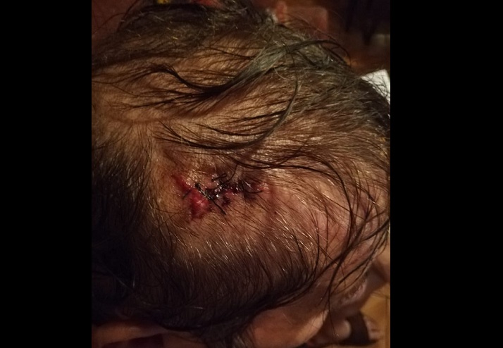 Adulto mayor de 74 años fue asaltado y golpeado por un desconocido en Curicó