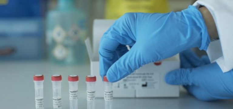 Región del Maule registra 62 casos confirmados de Covid-19