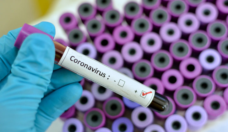 Región del Maule registra 333 casos de Covid-19 y 87 recuperados