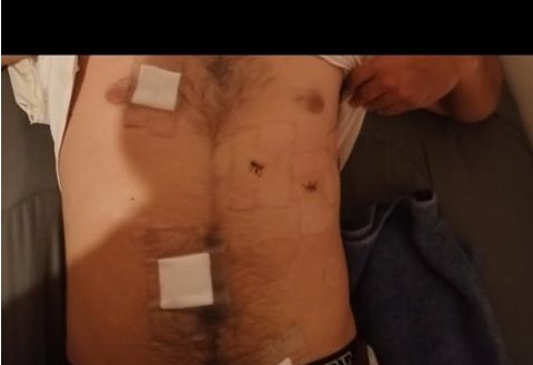 Vecinos de Llico denunciaron impunidad de sujetos que habrían apuñalado a jóvenes