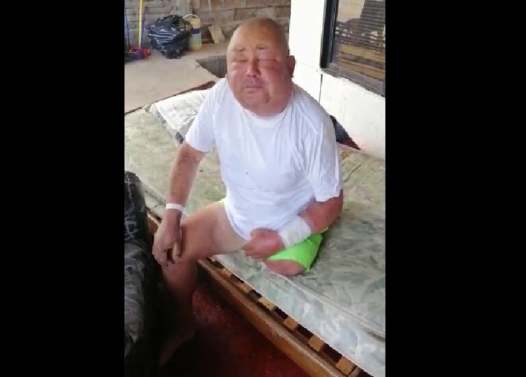 Adulto mayor de Curicó pide ayuda para internar a su hijo enfermo y postrado