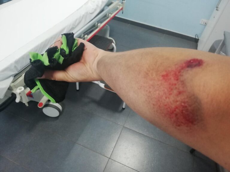Colectivero abandona a ciclista tras atropellarla en Curicó