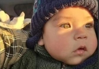 En riesgo vital gemelo curicano de siete meses trasladado por virus sincicial a Concepción