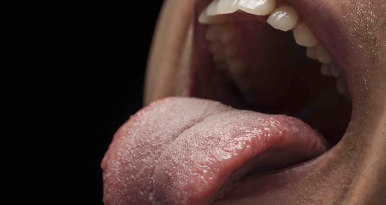 Departamento de Salud de Curicó recomienda medidas de prevención del cáncer oral